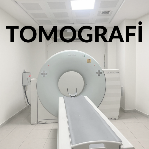 Tomografi